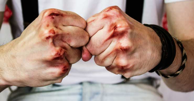 Quatro adolescentes são presos após agressão violenta em festa em casa em Estero.